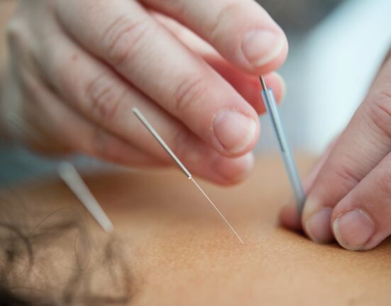 City Acupuncture in Columbus Circle, NY Offers Acupuncture Treatments