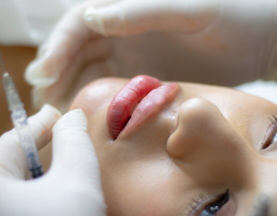 What Are Sculptra Treatments?